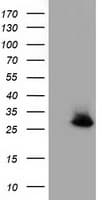 GSTT2 Antibody (clone OTI2E3)
