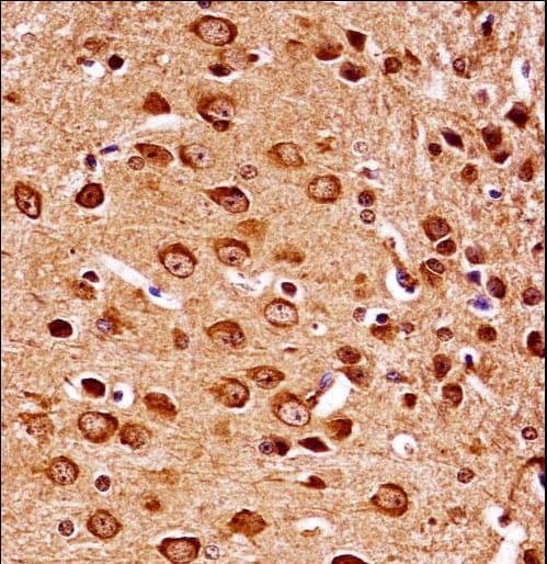 IHC-plus™ MAP2K7 / MEK7 Antibody (aa206-233)