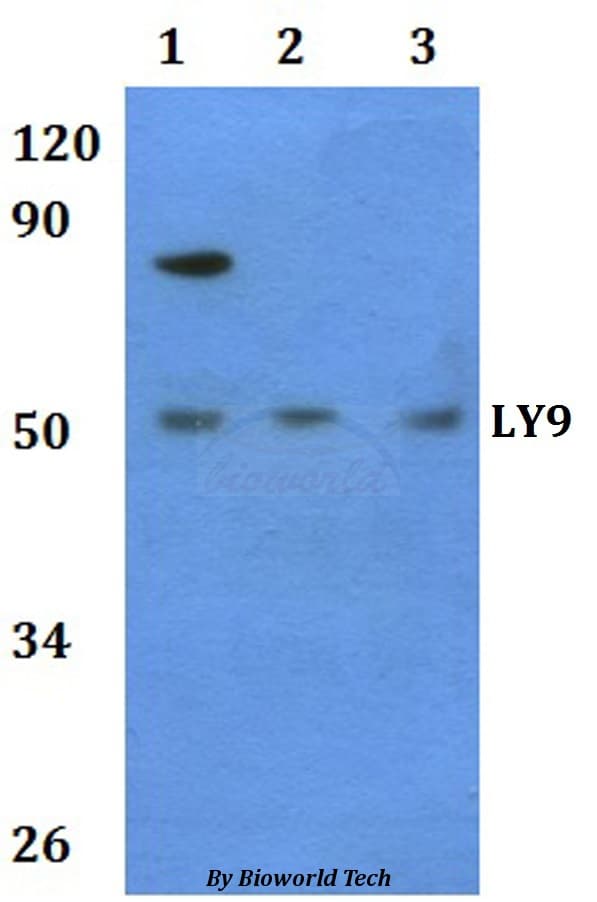 Polyclonal Rabbit anti-Human LY9 / CD229 Antibody (WB)