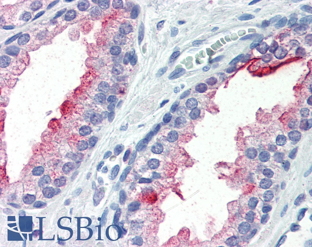 PathPlus™ FOLH1 / PSMA Antibody (clone Y-PSMA2)