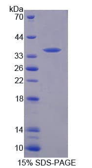 Mouse TIE1 / TIE Protein (Recombinant His-T7)