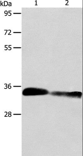 ACY3 Antibody