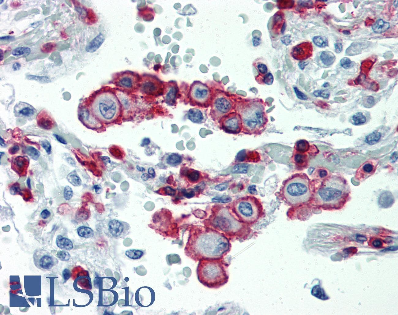 IHC-plus™ ITGB2 / CD18 Antibody (aa534-546, clone MEM-48, Low Endotoxin)
