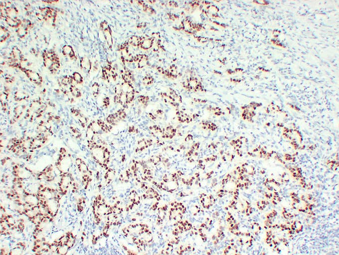PathPlus™ Monoclonal Mouse anti-Human SOX9 Antibody (IHC, WB)