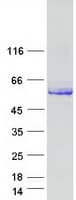 Human DOK7 Protein (Recombinant Myc-DDK (Flag))