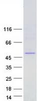Human FECH / Ferrochelatase Protein (Recombinant Myc-DDK (Flag))