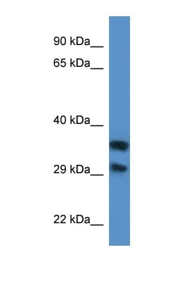 MRI1 Antibody (aa94-143)