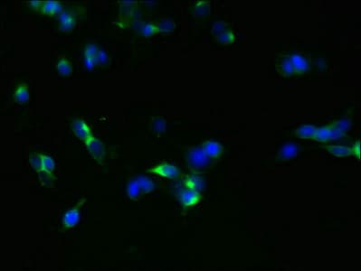 GLP1R / GLP-1 Receptor Antibody (aa24-145)