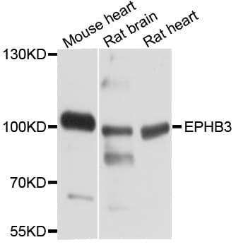 EPHB3 / EPH Receptor B3 Antibody