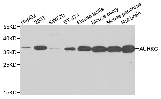 Polyclonal Rabbit anti-Human AURKC / Aurora C Antibody (IHC, WB)