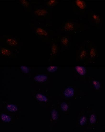 SF3B1 Antibody