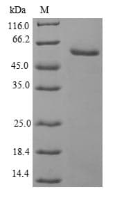 Human UBE2S / E2 EPF Protein (Recombinant GST, N-terminus)
