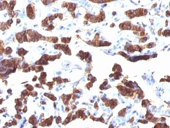 TG / Thyroglobulin Antibody (clone TGB24)