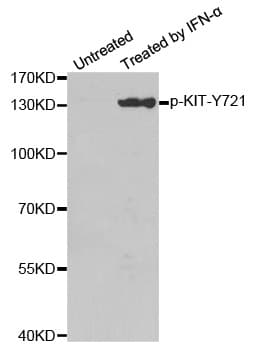 Polyclonal Rabbit anti-Human c-Kit / CD117 Antibody (phospho-Tyr721, WB)