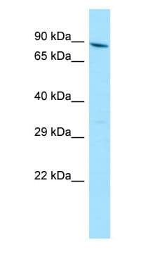 Polyclonal Rabbit anti-Human YTHDC1 Antibody (aa89-138, WB)