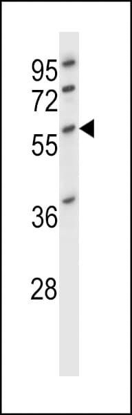 DES / Desmin Antibody (aa332-359)