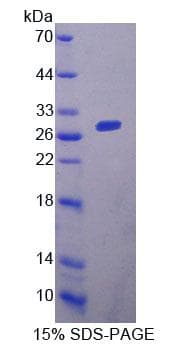 Mouse ACAA1 Protein (Recombinant His-T7, N-terminus)