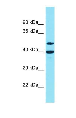 DBF4B / DRF1 Antibody (aa82-131)