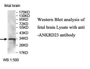 ANKRD23 / DARP Antibody (aa2-200)