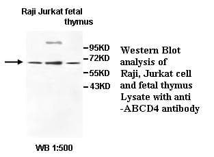 Polyclonal Rabbit anti-Human ABCD4 Antibody (IHC, WB)