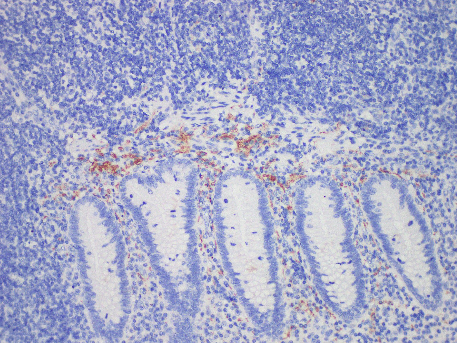 Monoclonal Mouse anti-Human CALB2 / Calretinin Antibody (IHC)