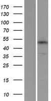 TMEM184C Protein (Over-Expression Lysate Myc-DDK (Flag))