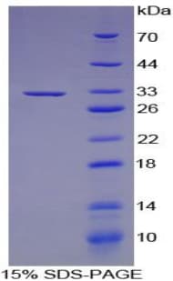 Human CYP27B1 Protein (Recombinant His-T7)