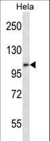ZFPM2 / FOG2 Antibody (aa883-911)
