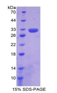 Human RNF112 / ZNF179 Protein (Recombinant His-T7)