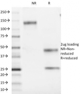 Monoclonal Mouse anti-Human CD1A Antibody (clone 66IIC7, IHC, IF)