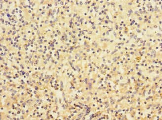 CHRNA2 Antibody