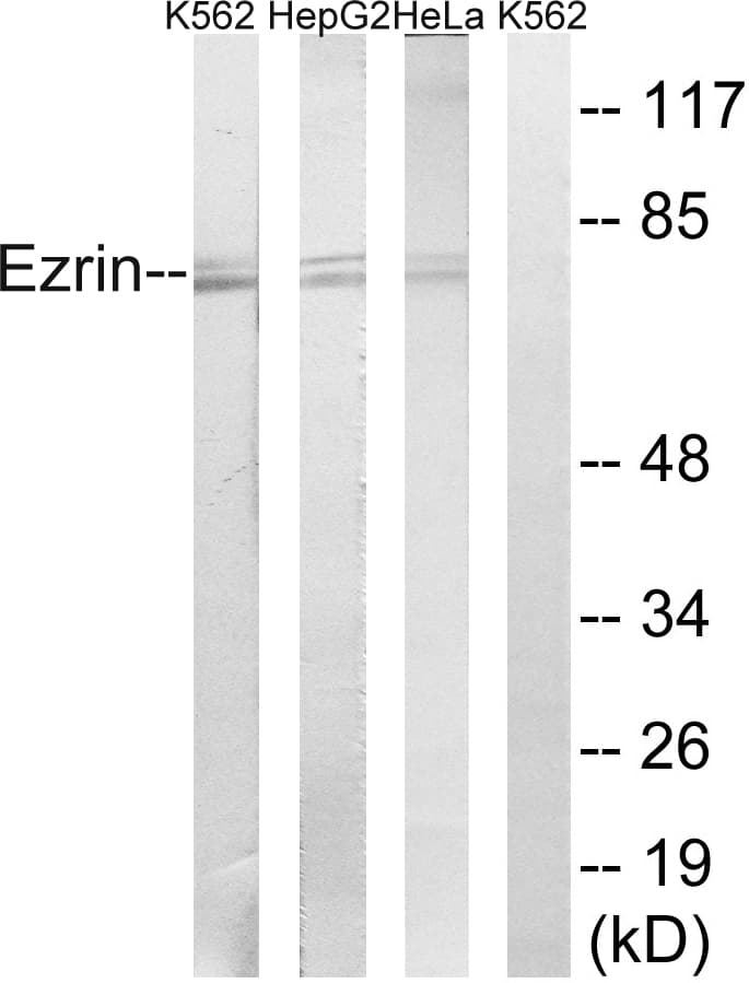 EZR / Ezrin Antibody (aa111-160)