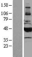 Human CYP2B6 Protein (Over-Expression Lysate Myc-DDK (Flag))