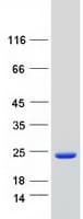 Human MRFAP1L1 Protein (Recombinant Myc-DDK (Flag))