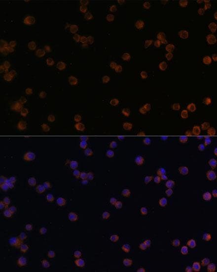 Polyclonal Rabbit anti-Human CHI3L1 / YKL-40 Antibody (IHC, IF)