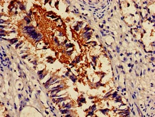 Polyclonal Rabbit anti-Human ACTN4 Antibody (IHC, WB)