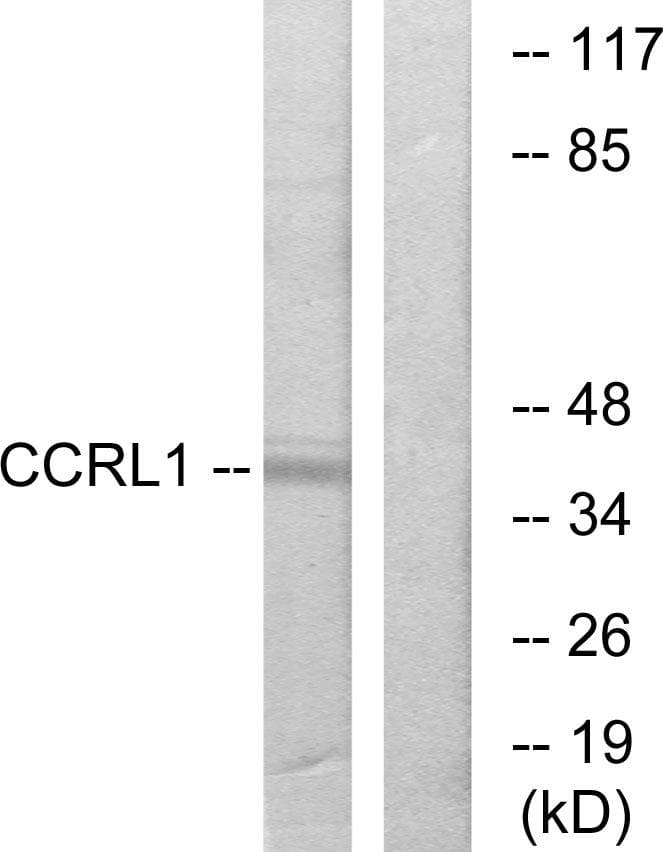 ACKR4 / CCRL1 / CCR11 Antibody