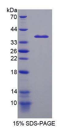 Rat ICK Protein (Recombinant His-S)