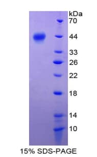 Human S100A2 Protein (Recombinant His-GST)