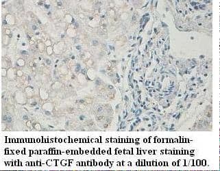 Polyclonal Rabbit anti-Human CTGF Antibody (IHC, WB)