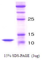 Human PTH / Parathyroid Hormone Protein (Recombinant)