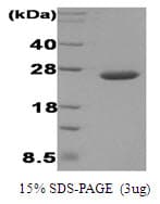 Human DsbC Protein (Recombinant)