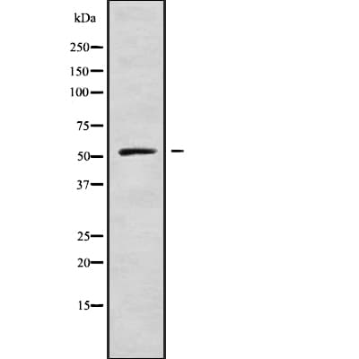 KRT86 / Keratin 86 / KRTHB6 Antibody