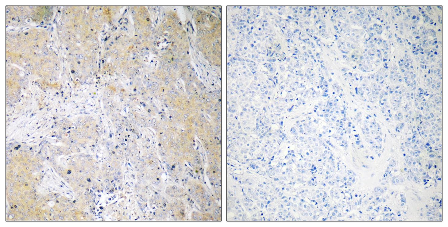 p58 / PSMD3 Antibody