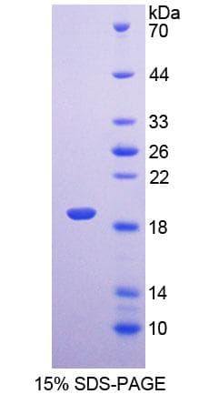 Rat LEPR / Leptin Receptor Protein (Recombinant His-T7)