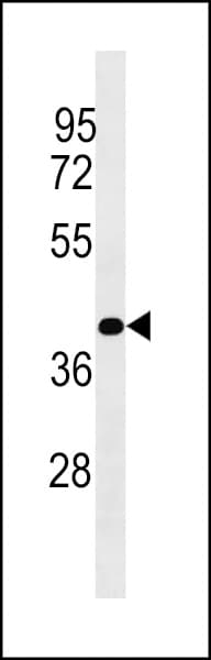 PLCXD1 Antibody (aa194-220)