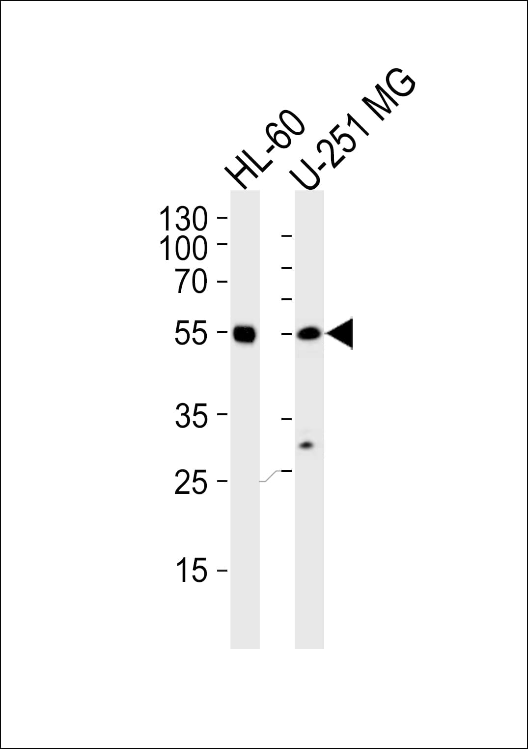 RELA / NFKB p65 Antibody (aa32-60)