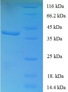 Human FOXP1 Protein (Recombinant GST)