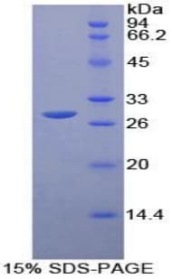 Mouse FCGR1A / CD64 Protein (Recombinant His-T7)