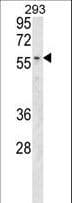 MBOAT2 Antibody (aa198-227)